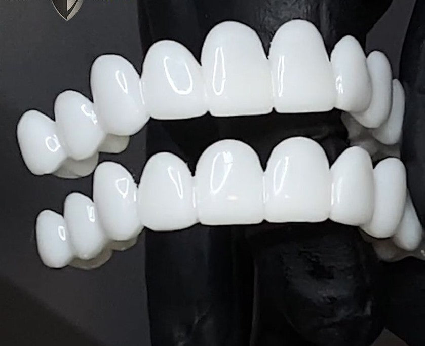 Zevolim | Snap-On Cosmetic Veneers | Instant Smile Cover for Imperfections