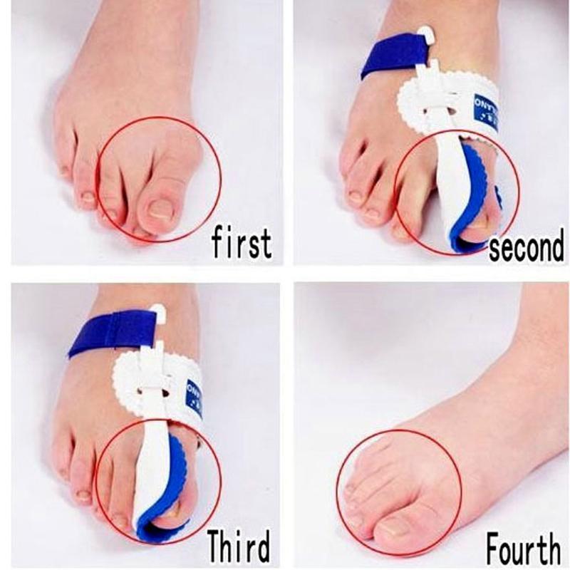 1 pair Bunion Adjuster Orthotics