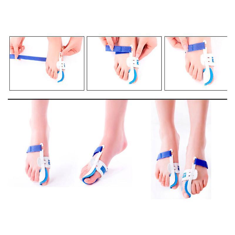 1 pair Bunion Adjuster Orthotics